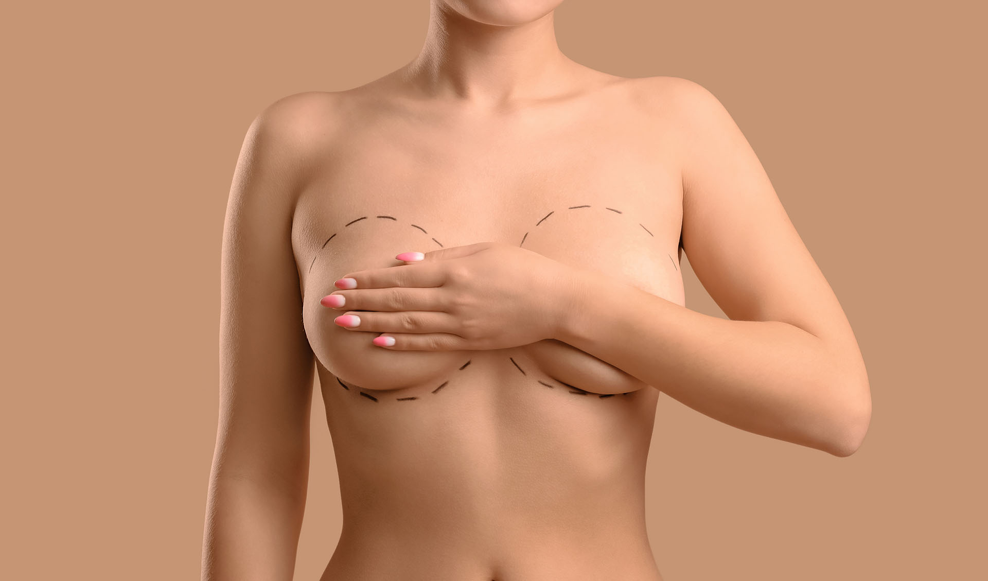 Implants mammaires. © Pixels-shot, Adobe stock